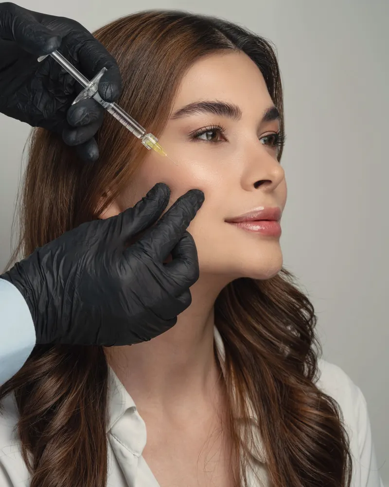 Aplicação de bioestimulador na região da maçã do rosto
